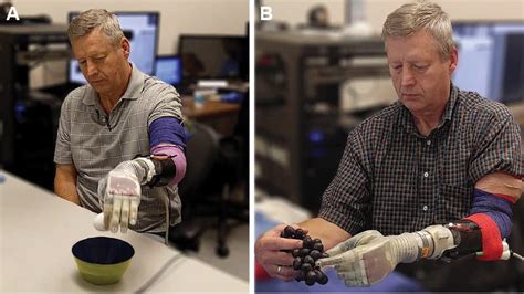 Scientists Have Created A Prosthetic Arm That Lets Patients Feel Touch