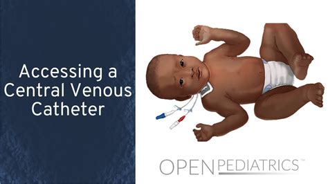 Accessing A Central Venous Catheter By Mary Jeanne Manning Rn For