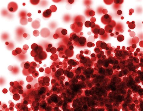 Iron Deficiency Anemia Causes Symptoms And Management