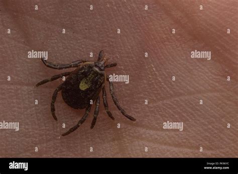 An Embedded Tick From Peru Ticks Are A Vectors Of Diseases Which