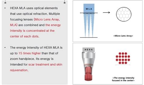 The company was established on december 12, 2014. PICOCARE Pico Laser Pigmentation SKIN Johor Bahru (JB ...