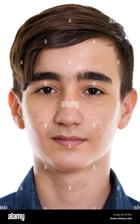 Acne Face Hi Res Stock Photography And Images Alamy
