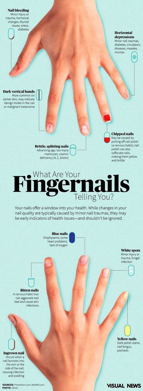 13 Dents And Marks On Fingernails What Do They Mean Ideas