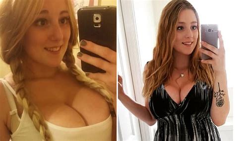 Woman With 36k Breasts Has Been Turned Down Twice By The Nhs For