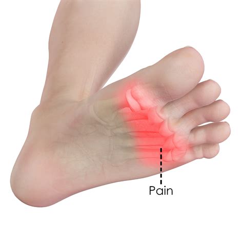 Major Causes Of Foot Pain Top Of Foot