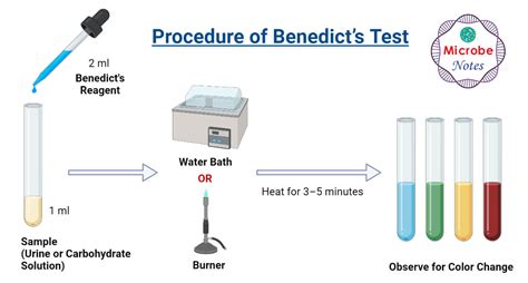 Benedicts Test Principle Procedure Steps Results Uses