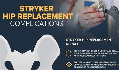 Stryker Hip Replacement Complication Infographic Visualistan