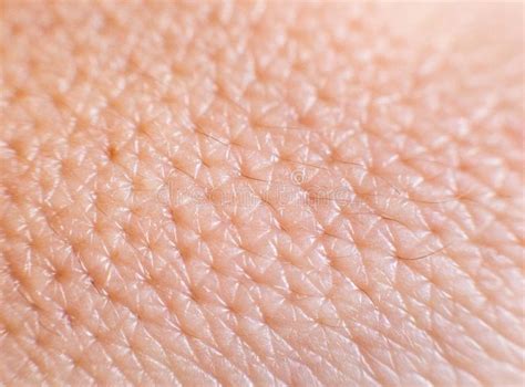 Closeup Of Porous Oily Human Skin Large Pores On The Skin Background Macro Cosmetology Stock
