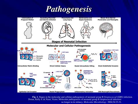 Ppt Streptococcus Agalactiae Gbs Powerpoint Presentation Free Download Id 9477541