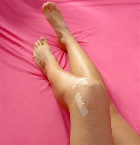 Join imgur emerald to award accolades! Best Knee Surgery Scars Stock Photos, Pictures & Royalty ...