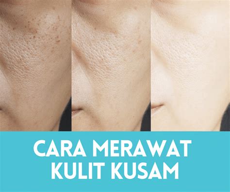 Cara Merawat Kulit Kusam 7 Tips Simple 2024 • Portal Kesihatan Anda