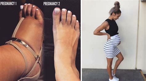 Pregnant Fitness Instructor Shares Swollen Foot Photo