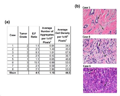 Characterization Of Hande Stained Histologic Sections Of Human Breast