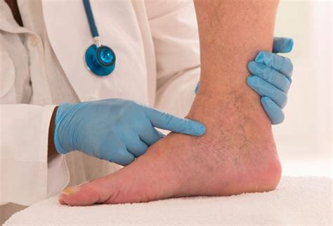 Lymphedema Symptoms Treatments And Causes