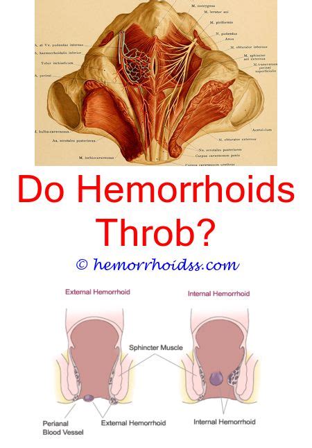 However, it will take longer for recurrent hemorrhoids to heal. Pin on How To Treat Hemorrhoids