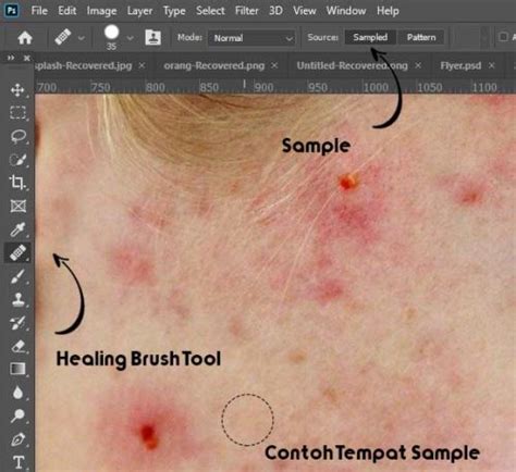 Maybe you would like to learn more about one of these? 2 Cara menghilangkan jerawat di photoshop dengan cepat