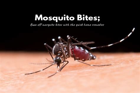 How To Treat Mosquito Bites 4 Natural Remedies That Work How To Cure