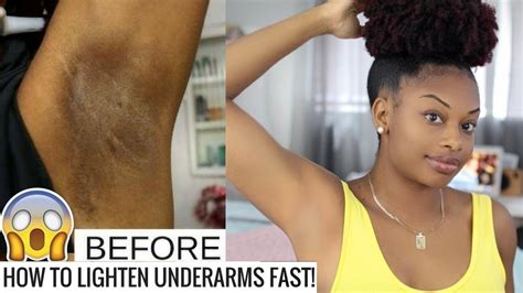 2 Months Update How To Lighten Dark Underarms Naturally And Fast Journeytowaistlength Youtube