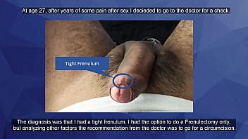 Free Foreskin Porn Videos 2 079 Tubesafari