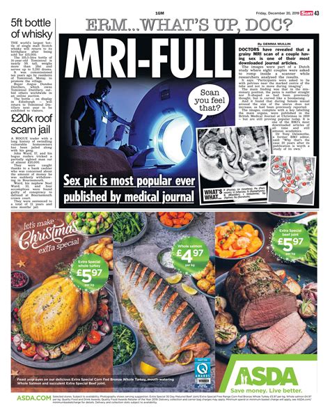 The Sun Mri Scan Of Couple Having Sex Is Most Popular Medical Journal