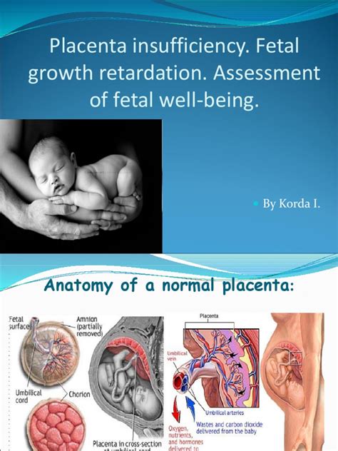 Assessing Fetal Well Being Evaluating Placental Function And Fetal