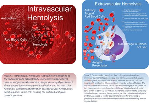 Hb metabolism partly occurs in tissue macrophages, which can engulf senescent erythrocytes (extravascular hemolysis) or take up hb released from ruptured erythrocytes (intravascular. allogenic mesenchymal stem cell therapy for imha in dogs ...