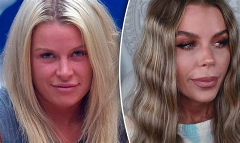 Big Brother Star Skye Wheatley Plastic Surgery Before And After