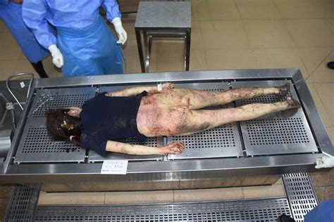 Autopsy Of The Body Of A Stabbed Chinese Woman Herdeaths