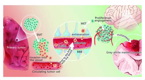 Mechanism Of Lung Cancer Brain Metastasis The Changes Of Tumor