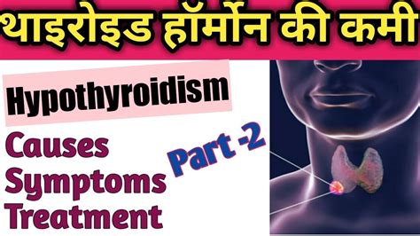 thyroid।। hypothyroidism cause symptom and treatment in hindi youtube