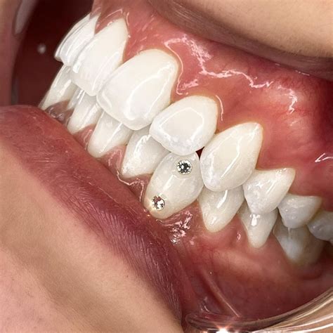 Tooth Gems Richmond Va On Instagram Stack ‘em Up Two Small Medium