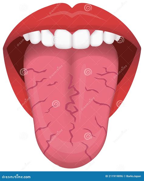 Tongues Health Sign Vector Illustration Wavy Tongue Cartoondealer