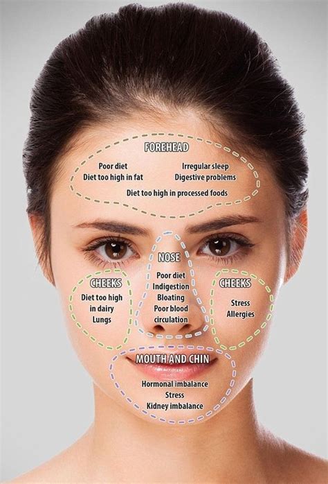 Acne Face Map What Your Acne Is Trying To Tell You About Your Health
