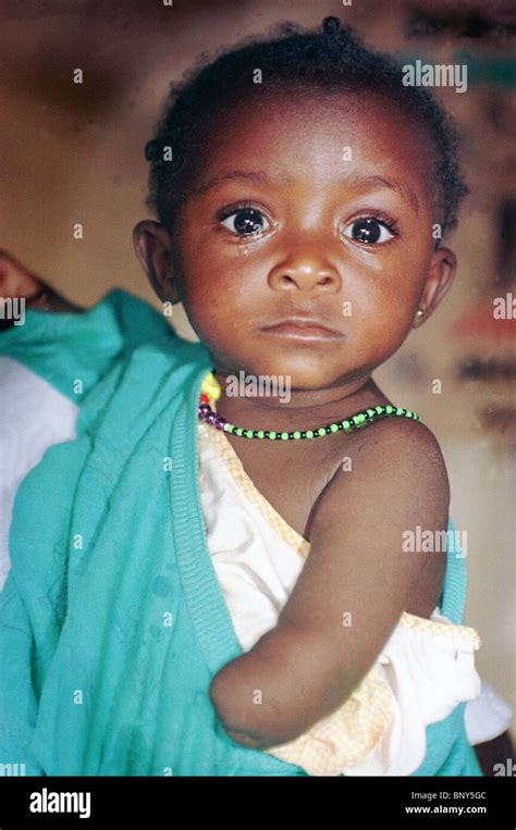 Baby Amputee In Freetown Sierra Leone Her Hands Were Amputated By The