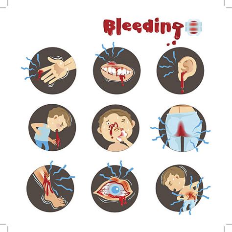 Sores On Gums Illustrations Royalty Free Vector Graphics And Clip Art