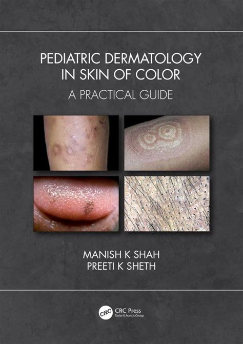 Pediatric Dermatology In Skin Of Color A Practical Guide Manish K