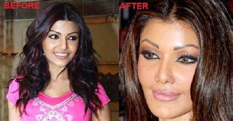 11 Bollywood Plastic Surgeries That Horribly Went Wrong