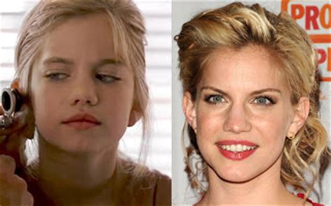 A bad nose job, is sometimes worse than never doing it at all. Anna Chlumsky Nose Job