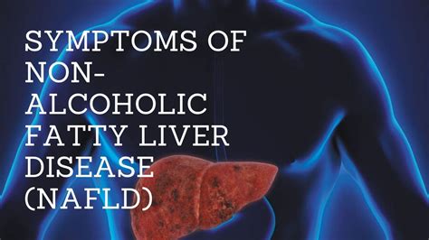 Symptoms Of Non Alcoholic Fatty Liver Disease Nafld Youtube