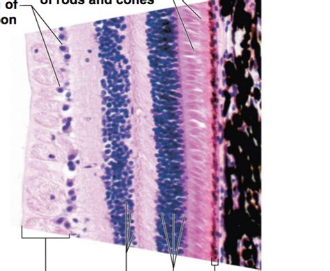 Microscopic Anatomy Of The Retina Histological Slide Diagram Quizlet