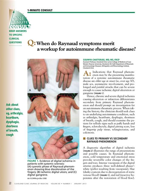 When Do Raynaud Symptoms Merit A Workup For Autoimmune Rheumatic