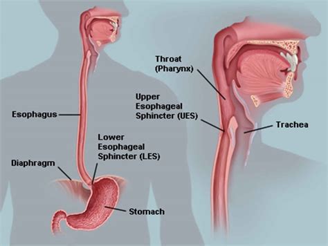 Esophageal Dysmotility Esophageal Motility Disorder Causes Symptoms Diagnosis Treatment
