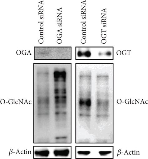 Effects Of Oga And Ogt Knockdown On Autophagy In Astrocytes A