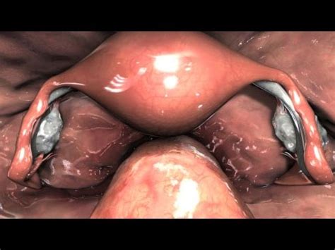 Diagnostic Pelvic Laparoscopy Exam - YouTube