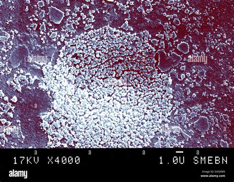 Mycoplasma Hominis Microscopio Fotografías E Imágenes De Alta Resolución Alamy