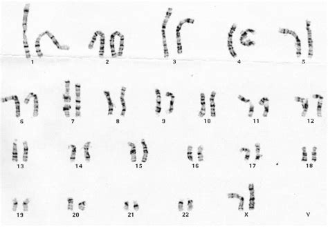 Dna And Chromosomes Bsci 1510l Literature And Stats Guide Research