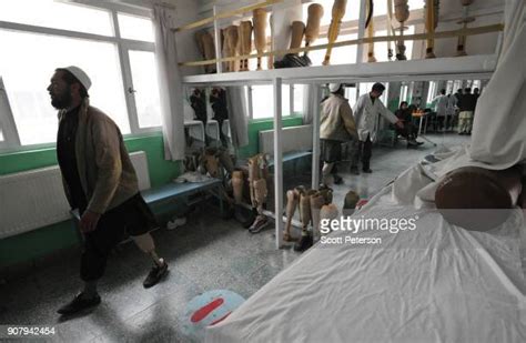 Afghanistan Orthopedic Center Helps War Victims Despite Reducing