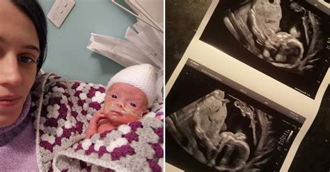 Mom Was Told Baby Died in the Womb, Gives Birth to Son 4 Weeks Later