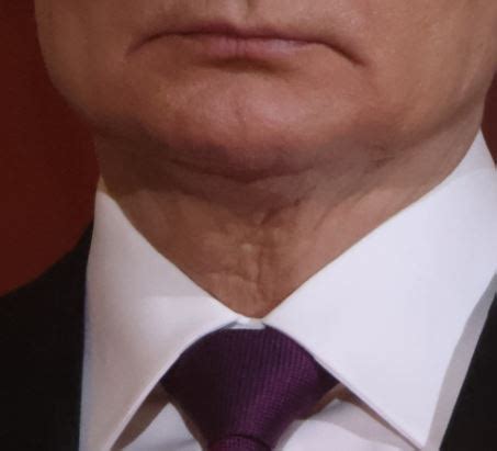 Vladimir Putin Spotted With Mystery Prominent Scar On His Neck As