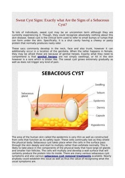 Sweat Cyst Signs Exactly What Are The Signs Of A Sebaceous Cyst Pdf